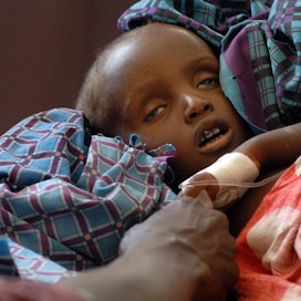 Vakavasti aliravittu lapsi Somalian Mogadishussa vuonna 2011, jolloin alueella kärsittiin vakavasta kuivuudesta.