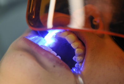 Väitöstutkimus tehtiin Oulun yliopistossa.