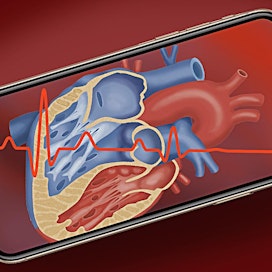 Joukko lääkäreitä varoitti julkaistussa kirjeessään uuden iPhone 12- puhelimen voimakkaan magneettikentän vaikutuksista sydämen tahdistimeen.