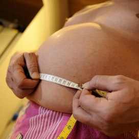 Diabeteksen ja ylipainon yhteisvaikutus tuli kolmanneksi, kun syövän aiheuttajien yleisyyttä vertailtiin.