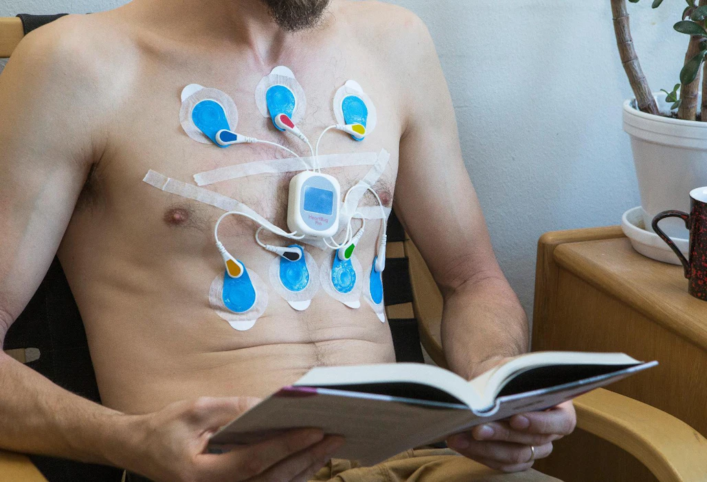 Holter-laite kerää potilaan sydänkäyrätietoja vähintään 24 tunnin ajan rintaan kiinnitetyillä elektrodeilla. Dataa analysoimalla lääkäri - tai tekoäly - saa selville, onko sydänsairautta syytä epäillä.