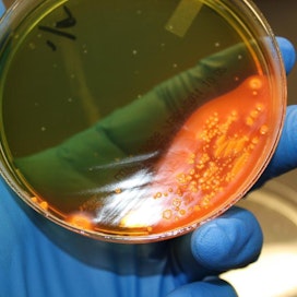 E.coli-bakteeri on aiheutanut viime ja tänä vuonna neljä usean osavaltion alueelle levinnyttä epidemiaa. Kuvassa e.colin kasvualusta laboratoriossa.