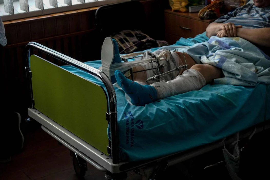 Sota Ukrainassa osuu raskaasti siviileihin. Loukkaantunut ukrainalaisnainen sairaalahoidossa Zaporizhzhjan kaupungissa.