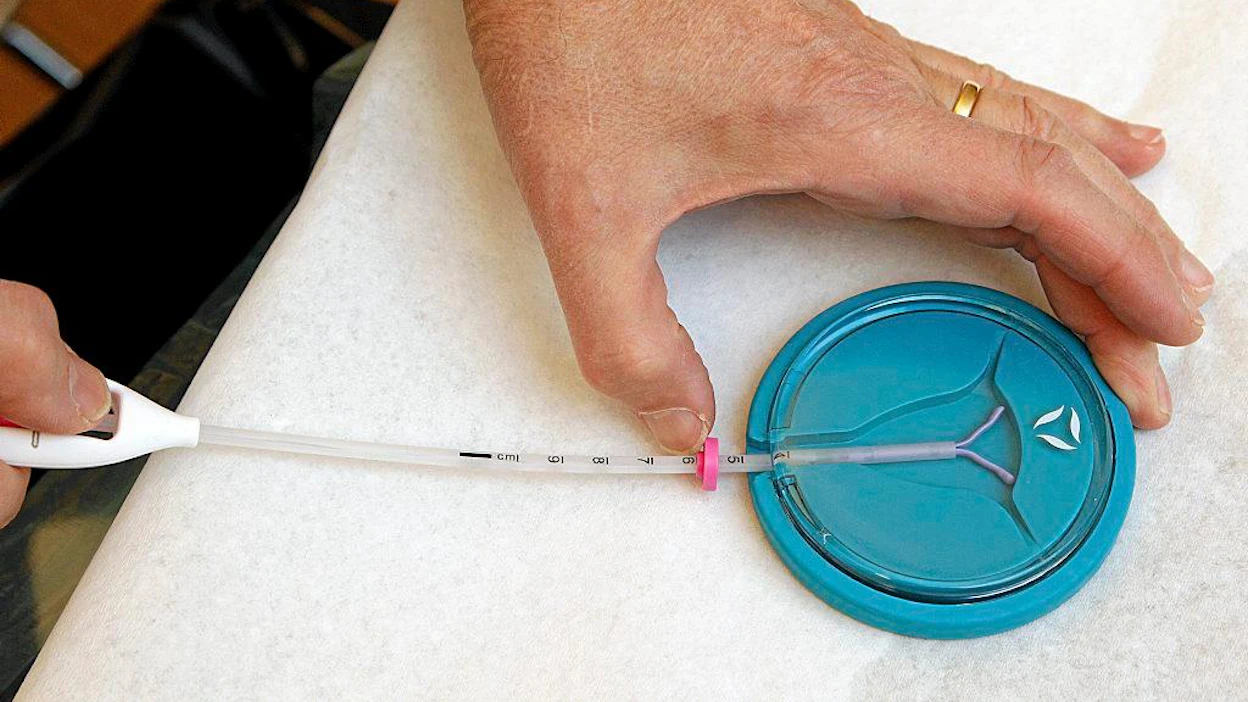Ehkäisymenetelmänä huimasti kehittynyt hormonikierukka on korvannut monen naisen kohdalla sterilisaation.