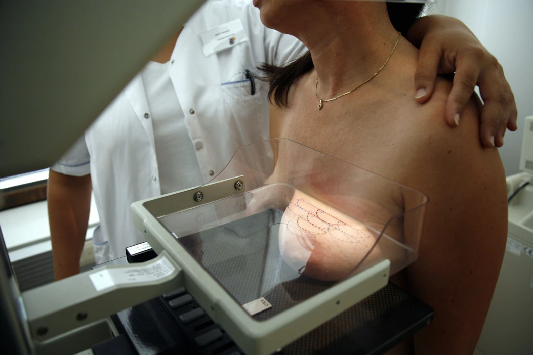 Rintasyövän ja suolistosyövän seulontoihin on osallistunut viime vuosina noin neljä viidestä seulontaan kutsutusta suomalaisesta. Kuvassa mammografiatutkimus. LEHTIKUVA / Sari Gustafsson.