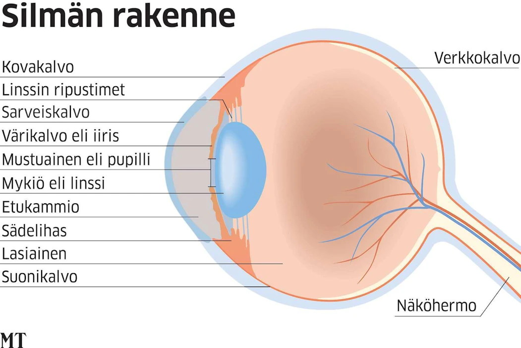 Tältä näyttää silmän rakenne. Suomessa yleisimpiä silmän sairauksia ovat pintasairaudet, kuten kuivasilmä ja silmän eri osien tulehdukset.