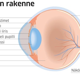 Tältä näyttää silmän rakenne. Suomessa yleisimpiä silmän sairauksia ovat pintasairaudet, kuten kuivasilmä ja silmän eri osien tulehdukset.