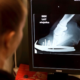 Eläinlääkäri tutkii röntgenkuvaa hevosen kaviosta.
